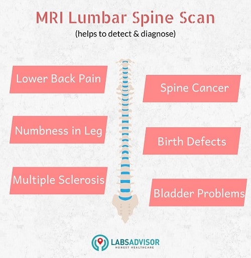Uses of MRI Ls Spine Scan.