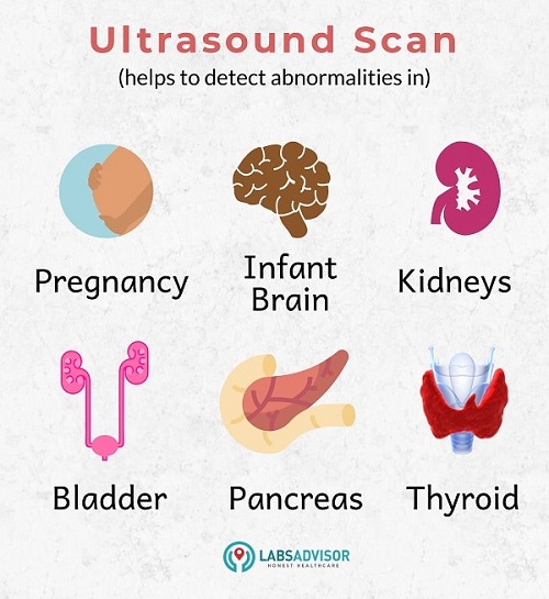 Internal organs that can be examined using an ultrasound scan/ sonography