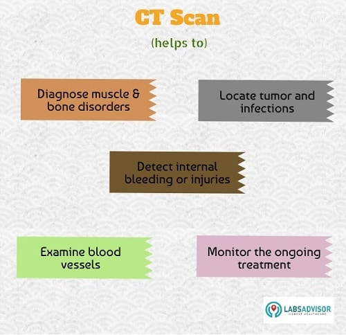 CT Scan in Delhi - Uses 
