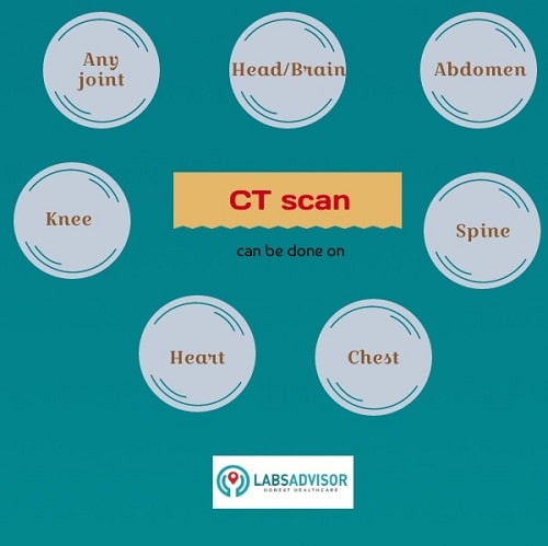 Know more about the different body parts that are covered in a CT scan in Gurgaon