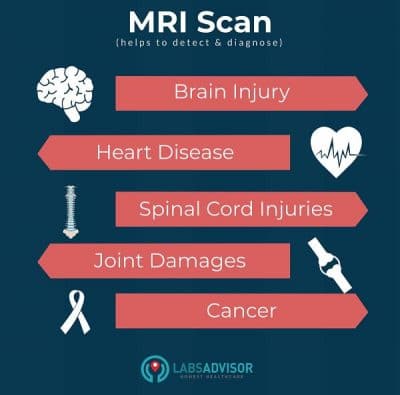Medical conditions that can be diagnosed using an MRI scan in Gurgaon