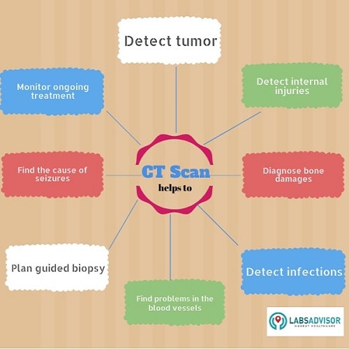 Know more about the different uses of a CT scan in Gurgaon!