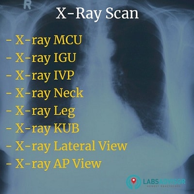 Different types of X-ray scan studies in Delhi!