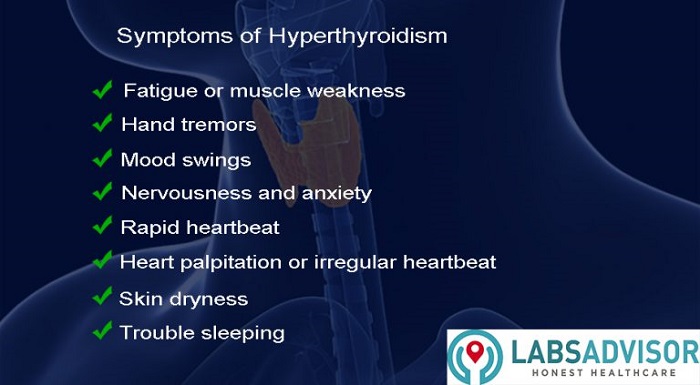 Symptoms of hyperthyroidism.