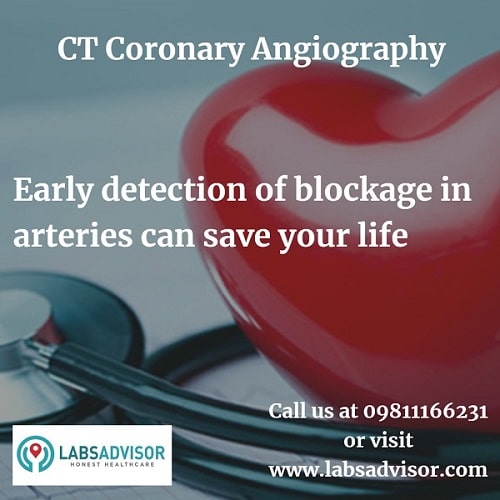 CT Angiography in Delhi - Procedure!