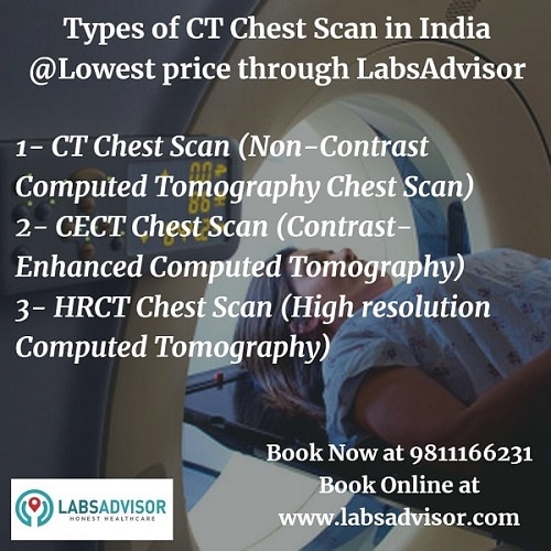 Types of CT Scan chest in India!