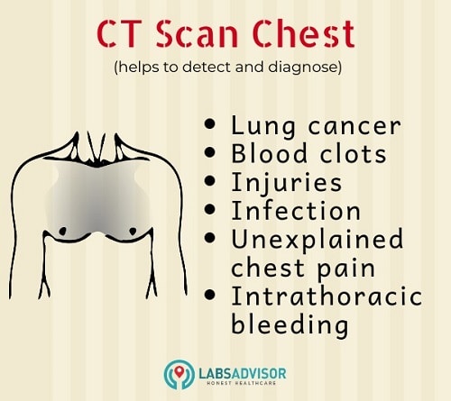 Use of CT scan chest - India
