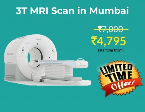 shocking-mri-scan-cost-in-mumbai-pay-half-the-scan-price