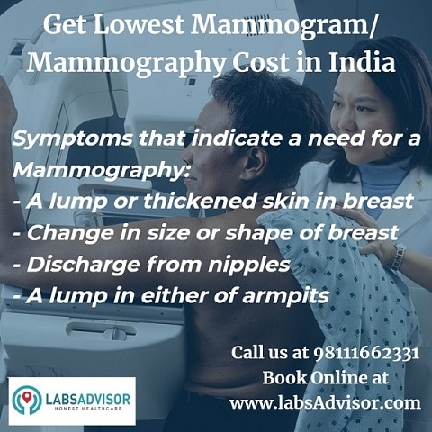 Symptoms of breast cancer and need for mammography.