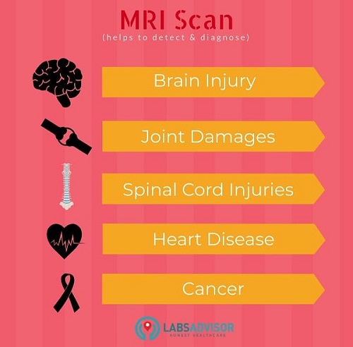 Medical conditions diagnosed with the help of an MRI scan in Bangalore!