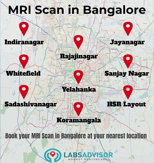 Book your MRI Scan in Bangalore at your preferred location!