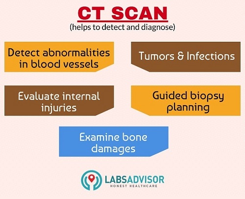 CT Scan in Chennai - Uses.