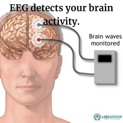 Procedure of EEG Test.