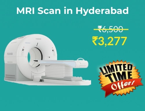 40-off-on-mri-scan-cost-in-hyderabad-from-3277-labsadvisor