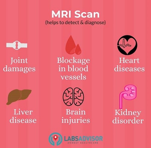 MRI Scan in Chennai - Uses