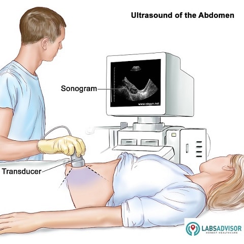 The procedure for a sonography abdomen - India!