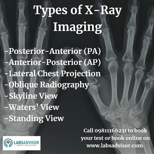 Types of X-Ray in India