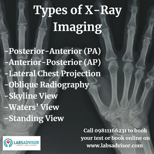 X Ray Price Starting From ₹170 Avail Up To 50 Off