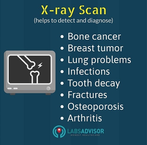 Uses of an X Ray Scan - Mumbai