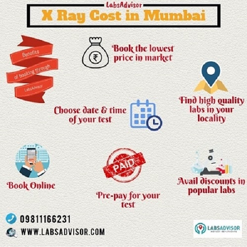 Book the lowest X Ray Cost in Mumbai in the most popular labs through LabsAdvisor. Also avail exclusive discounts on your booking.