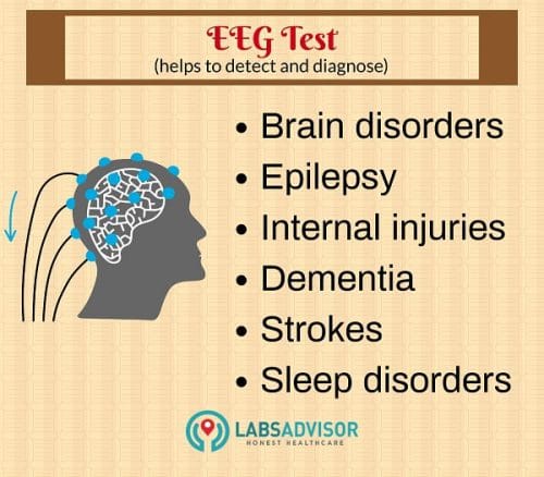 Uses of EEG Test.