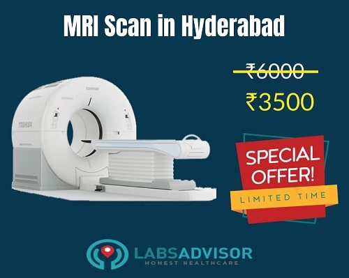 up-to-50-off-on-mri-scan-cost-in-hyderabad-from-3500-only