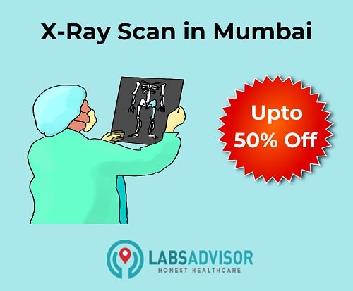 Up to 50% off on X ray cost in Mumbai!