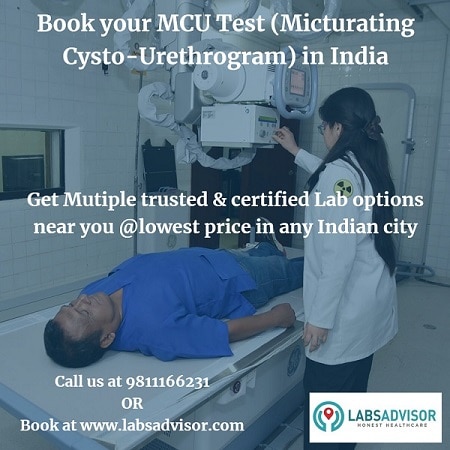 MCU Test Price in India