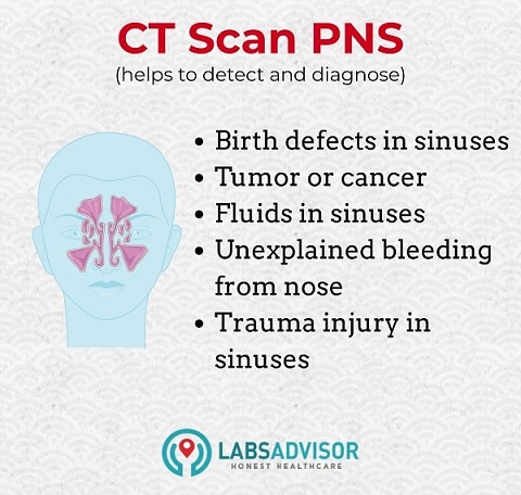Uses of CT scan PNS - India!