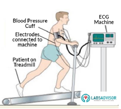 Patient running on a treadmill during the test.