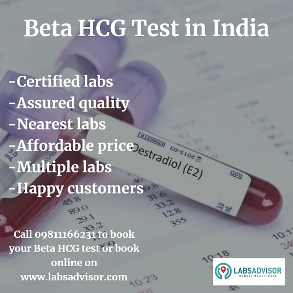 Sample Report of Beta HCG Test.