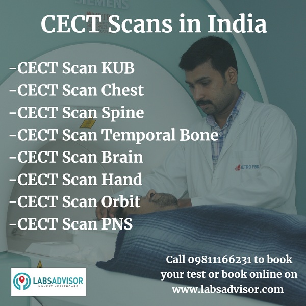View CECT KUB test cost and other CECT test cost in all the best labs in Delhi, Noida, Gurgaon, Hyderabad, Chennai, Bangalore, Mumbai, etc. Also book appointment online with discounts only on LabsAdvisor.com.