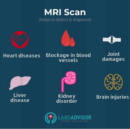 Uses of an MRI scan - India
