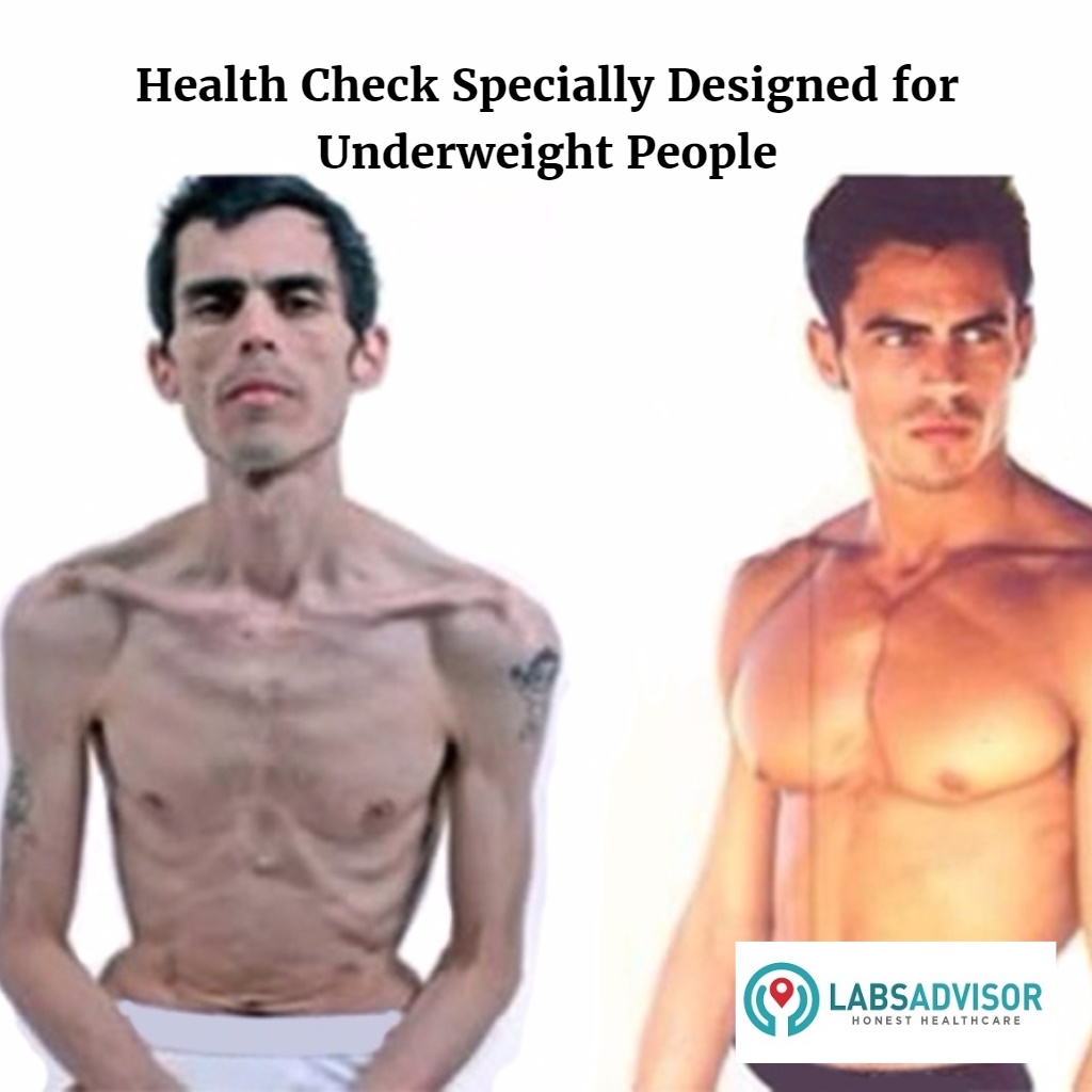 Book your underweight test that includes important parameters to know the reason for your underweight.