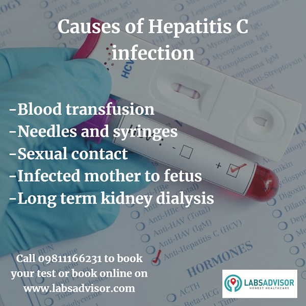 Causes of Hepatitis C.