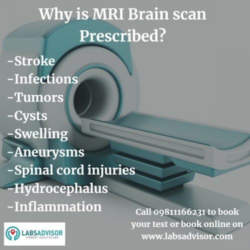 Learn more about the different reasons leading a doctor to prescribe an MRI brain scan.