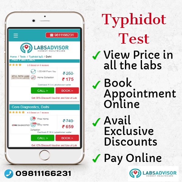 Lowest Typhidot Test Cost in Delhi, Gurgaon, Bangalore, Mumbai, Chennai, Hyderabad, etc through LabsAdvisor.