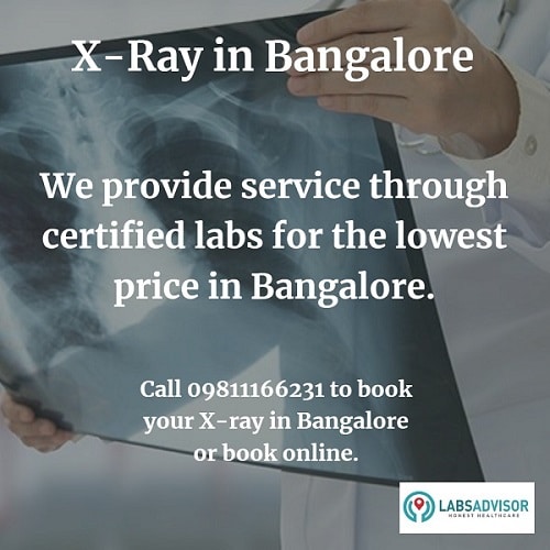Lowest X ray scan cost in Bangalore in the best labs through LabsAdvisor.