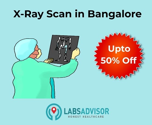 Lowest X-RAY Scan Cost in Bangalore!