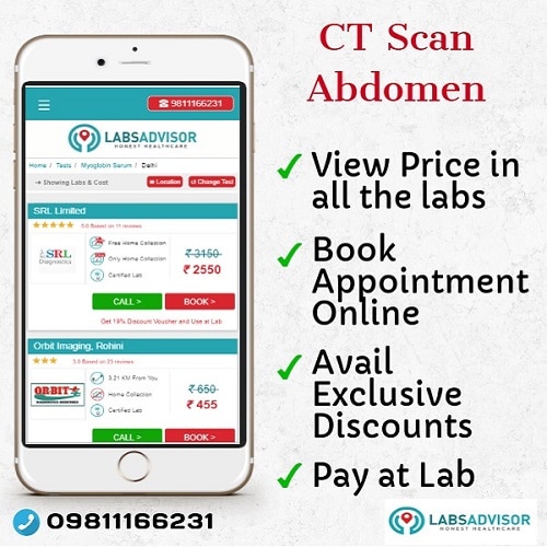 Lowest cost of various CT scan abdomen in Delhi, Gurgaon, Bangalore, Mumbai, Chennai, Hyderabad, etc.