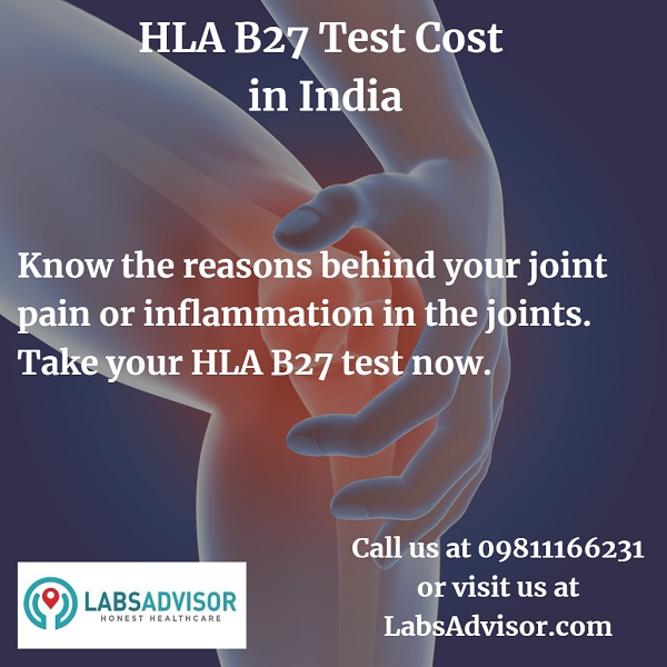Medical conditions diagnosed using HLA B27 Test.