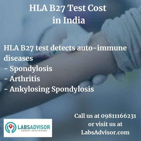 Possible interpretation of HLA B27 test results.