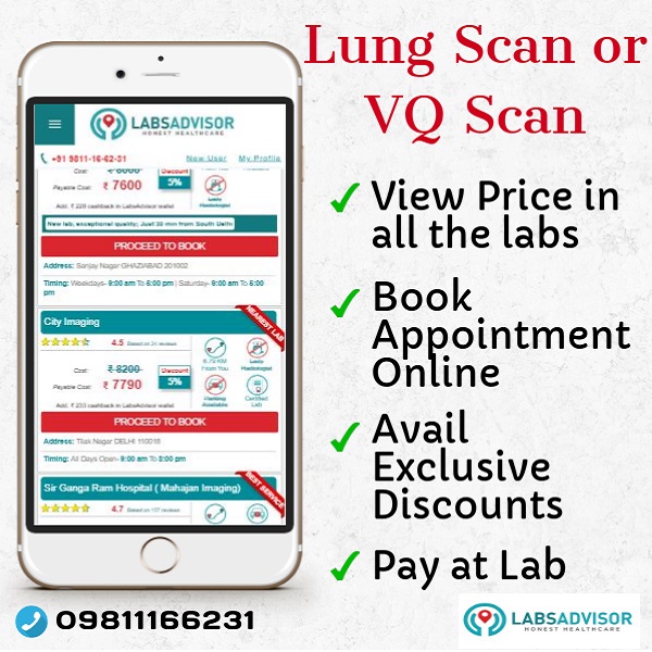Lowest VQ Scan Cost in Delhi, Gurgaon, Noida, etc through LabsAdvisor.