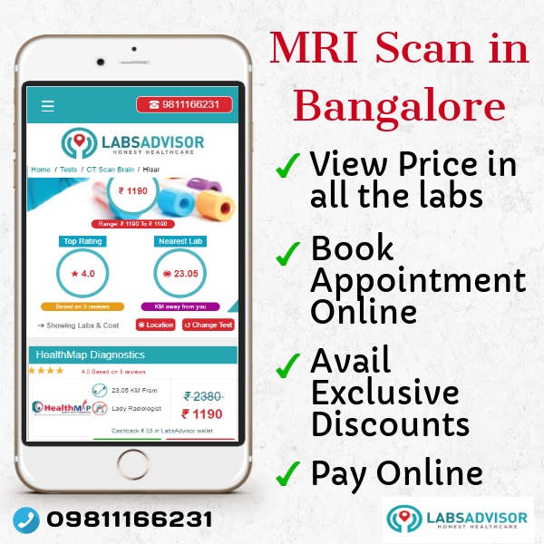 Best MRI Scan Labs in Bangalore.