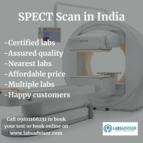 SPECT Scan Price in India!