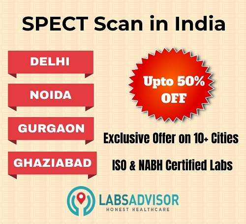 Lowest SPECT Scan Cost in India!