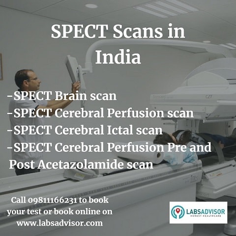 SPECT Scan Types in India!