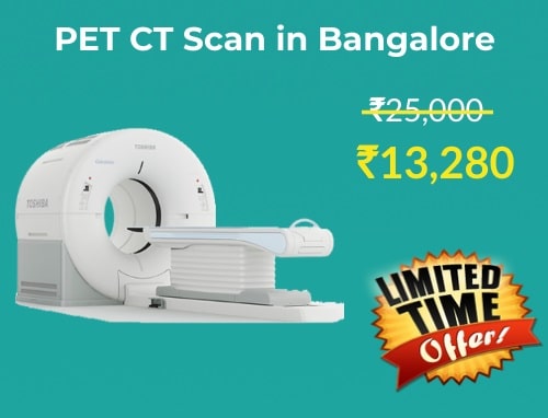 50% Off on PET CT Scan Cost in Bangalore | Only @ ₹13280 - LabsAdvisor.com