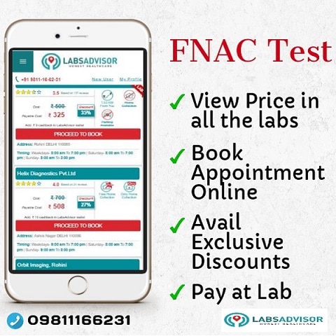 FNAC Test Cost in India Through Labsadvisor!