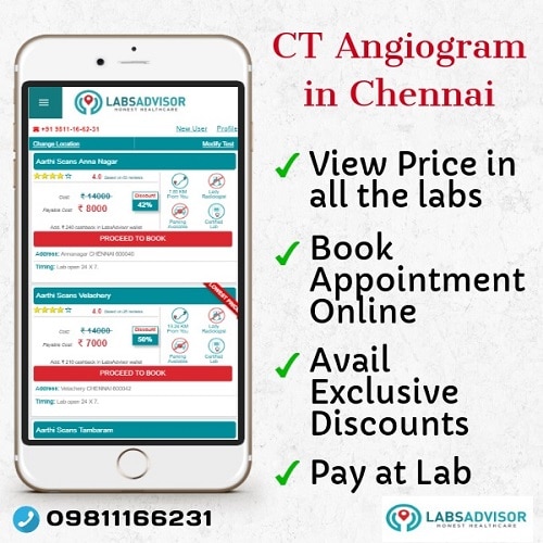 Lowest CT Angiogram Cost in Chennai in the best labs.